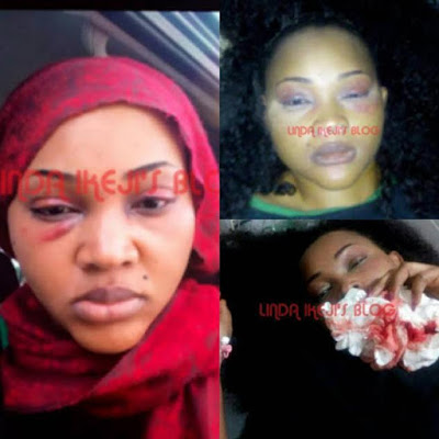 DOMESTIC VIOLENCE:MERCY AIGBE BATTERED BY HUSBAND